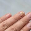 Fingernail Lifting Treatment Guide for Healthier Natural Nails